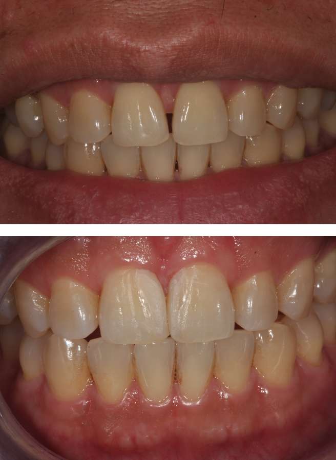 Special Dental Offer Coppell