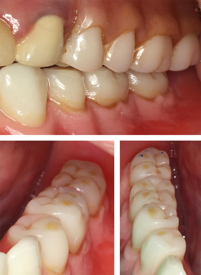 Special Dental Offer Coppell