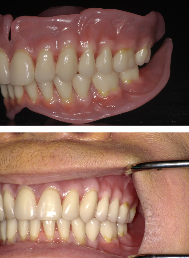 Special Dental Offer Coppell