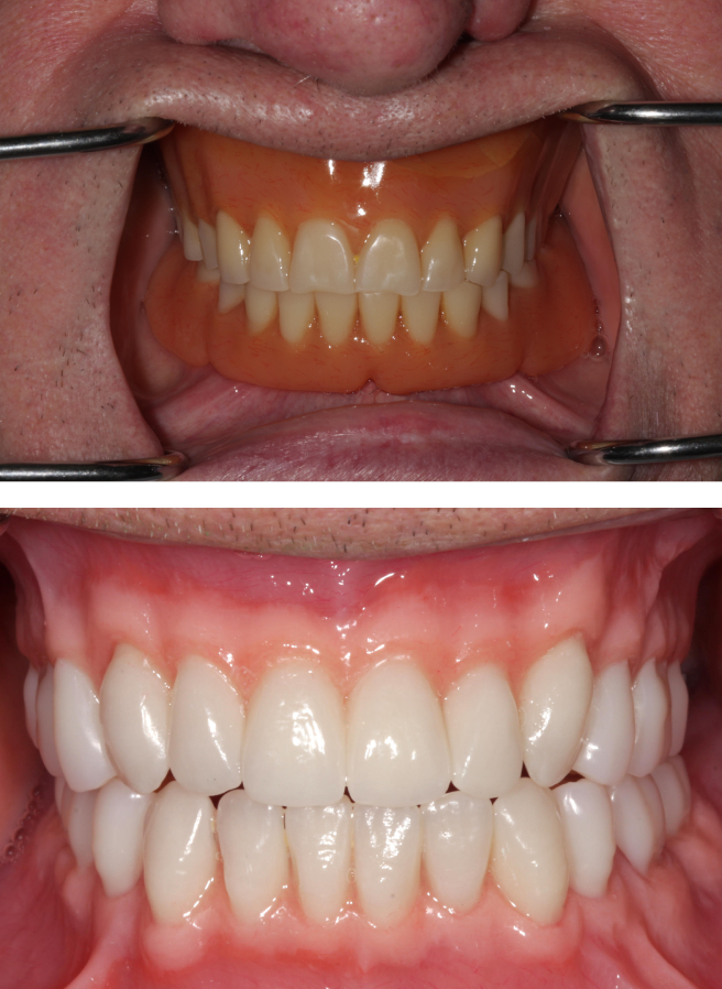 Special Dental Offer Coppell