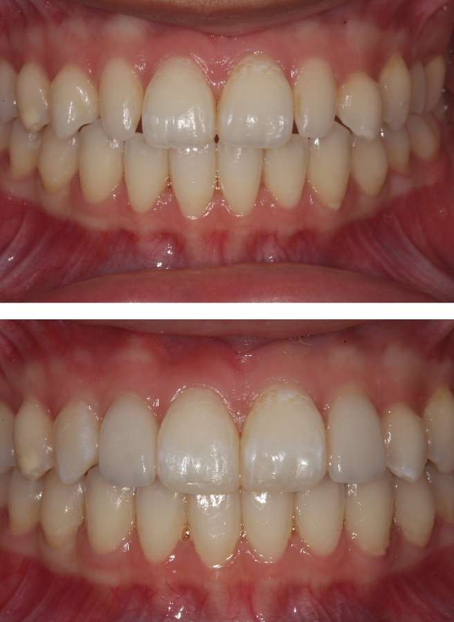 Special Dental Offer Coppell