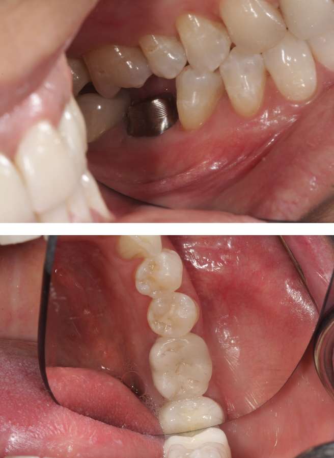 Special Dental Offer Coppell