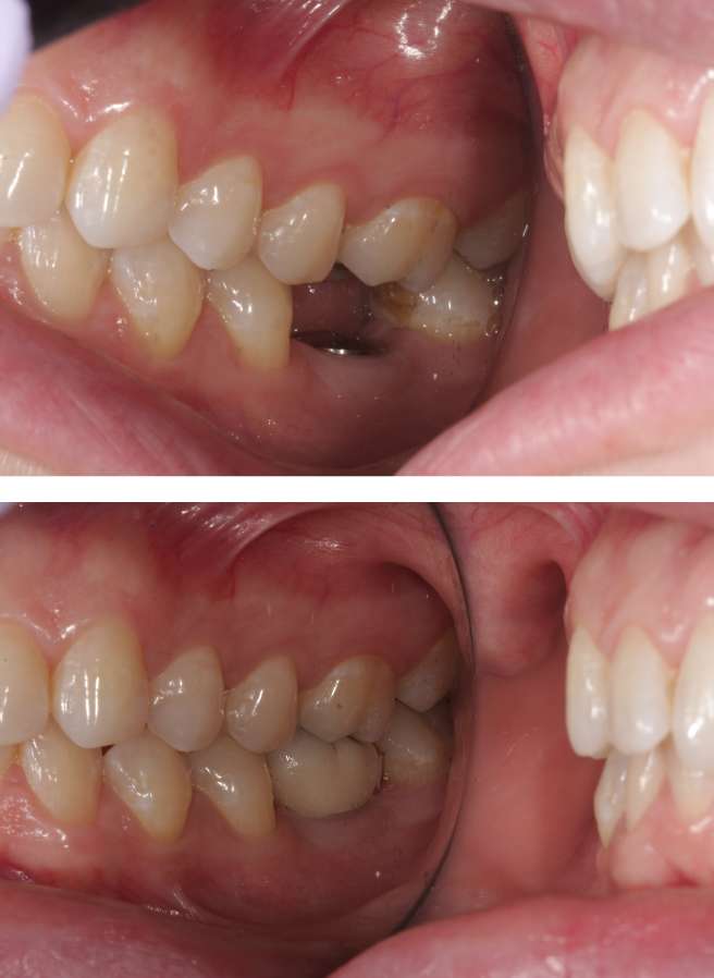 Special Dental Offer Coppell