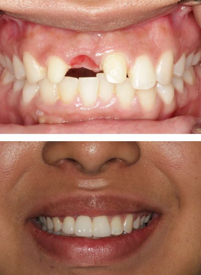 Special Dental Offer Coppell