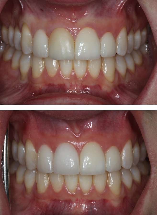 Special Dental Offer Coppell