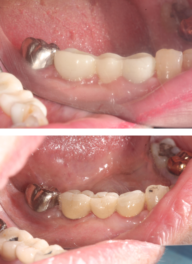 Special Dental Offer Coppell