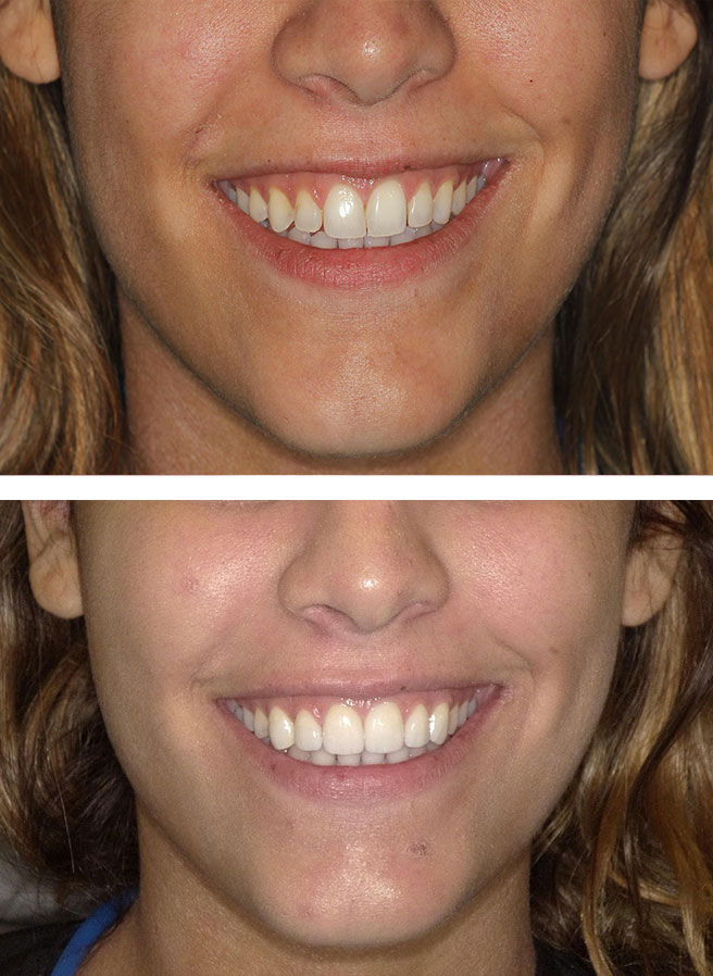 Special Dental Offer Coppell