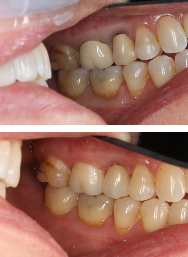 Special Dental Offer Coppell
